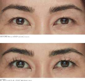 Buy Latisse, get a FREE Lash Tint