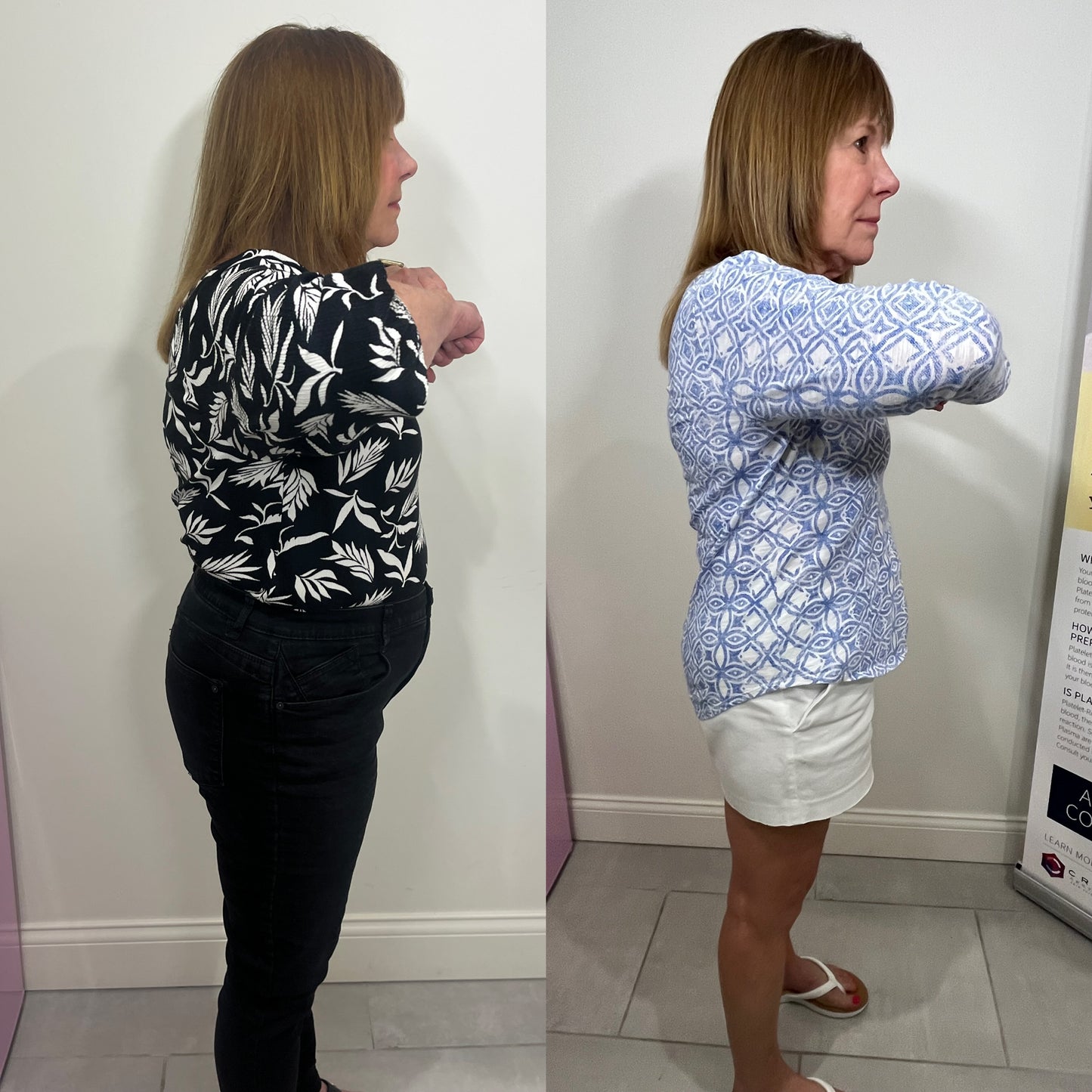 Weight Loss Package