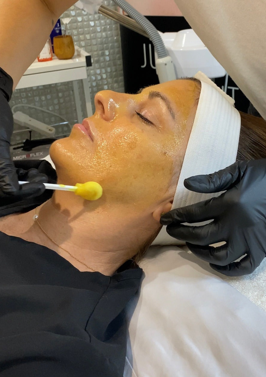 Buy Raw Beauty Skin Brightening Peel w/ homecare for $350 get second Skin Brightening Peel FREE (Save $225)